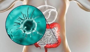 what tests should you take for parasites