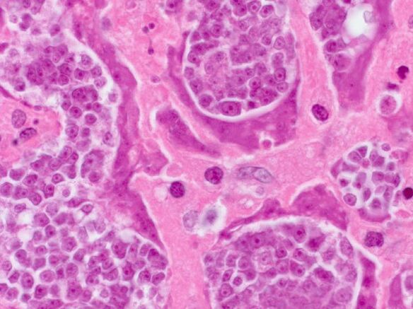 Parasites research in a person