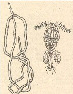 Female Guinea worm and larva grown in Cyclops