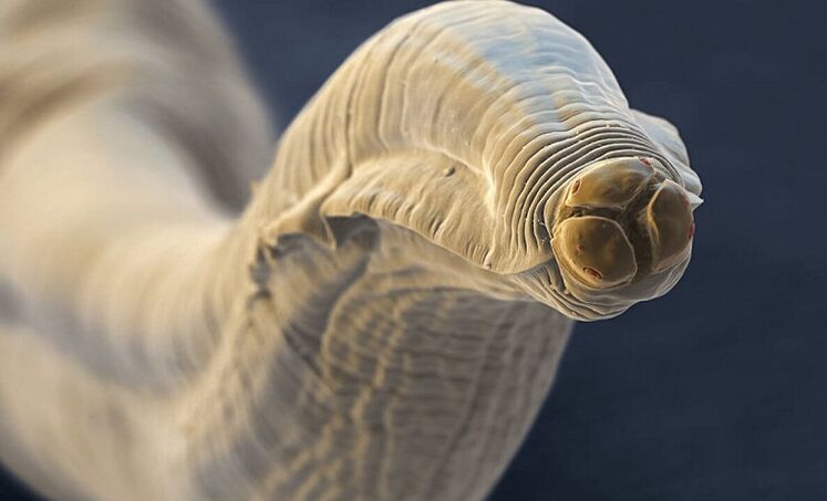 parasitic worms from the human body