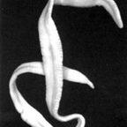 The ribbon parasites in the human body