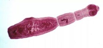 How to get rid of the parasites in the human body