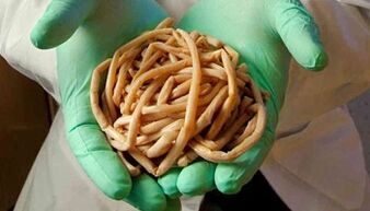 Methods of eliminating parasites from the body