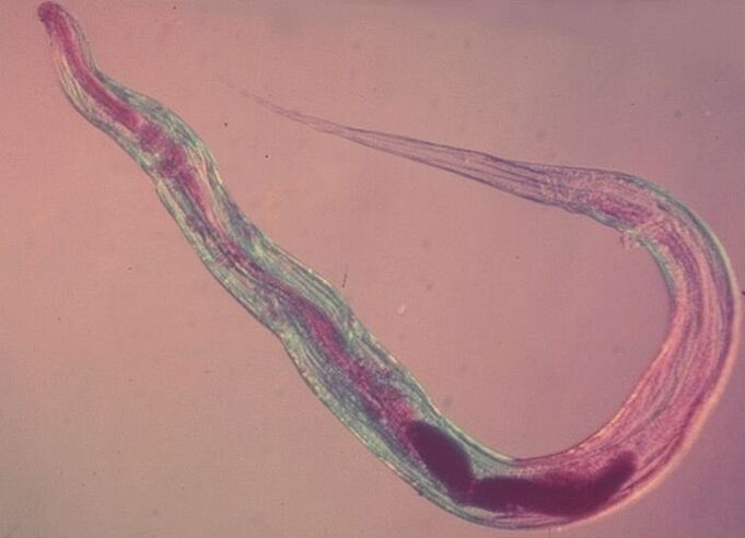 Penworm under a microscope